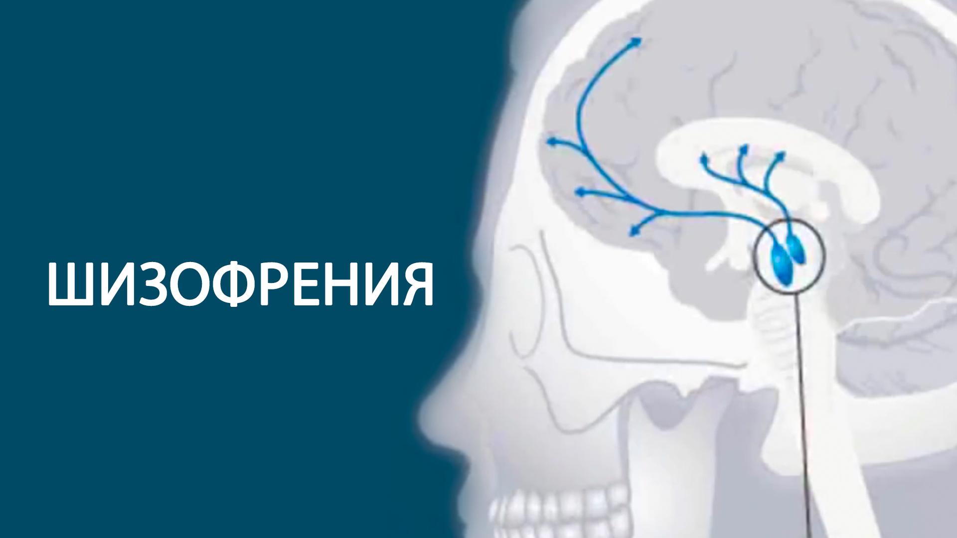 Шизофрения