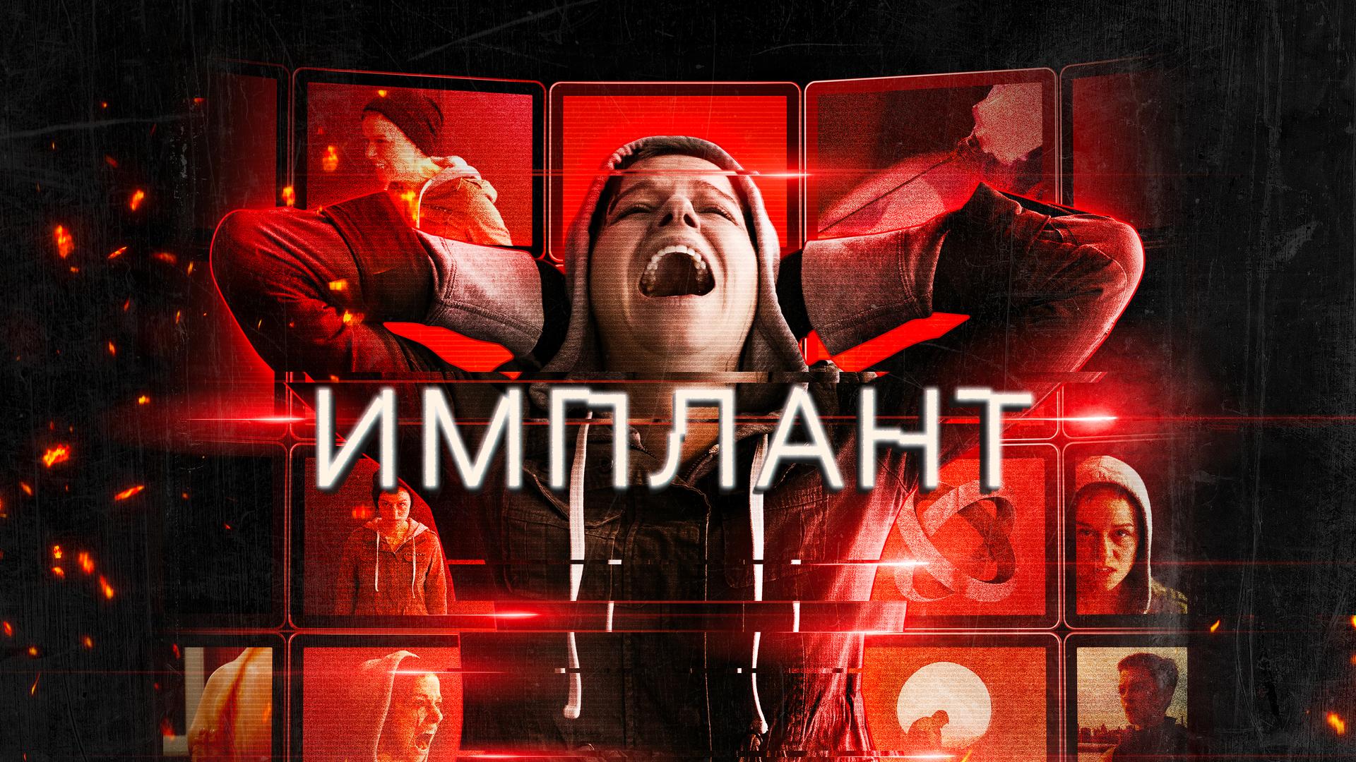 Имплант